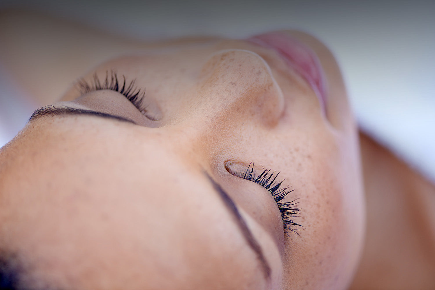 Forever Young BBL laser skin treatment from Beam